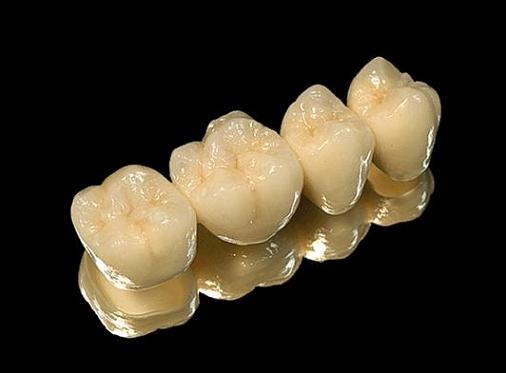 电脑氧化锆全瓷