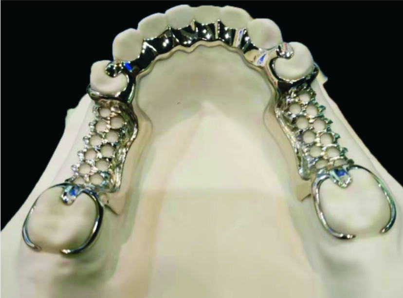 维他灵完美支架